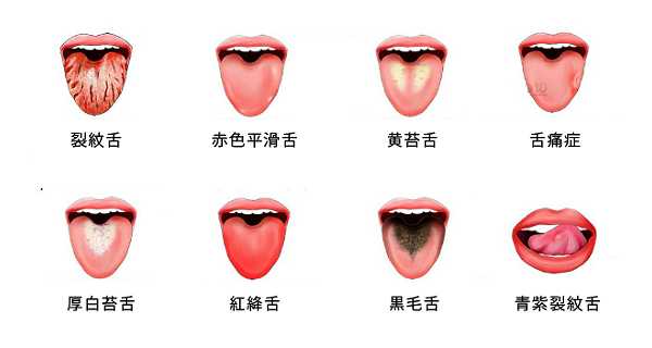Tongue_condition_12303.jpg