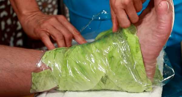 cabbage_poultice_01121.jpg